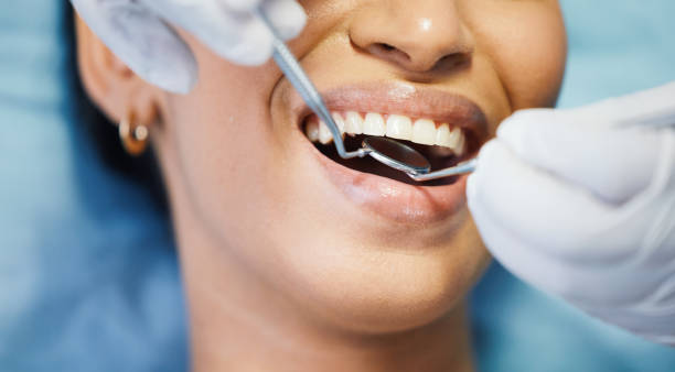 Best Emergency Tooth Extraction in Shawnee, OK